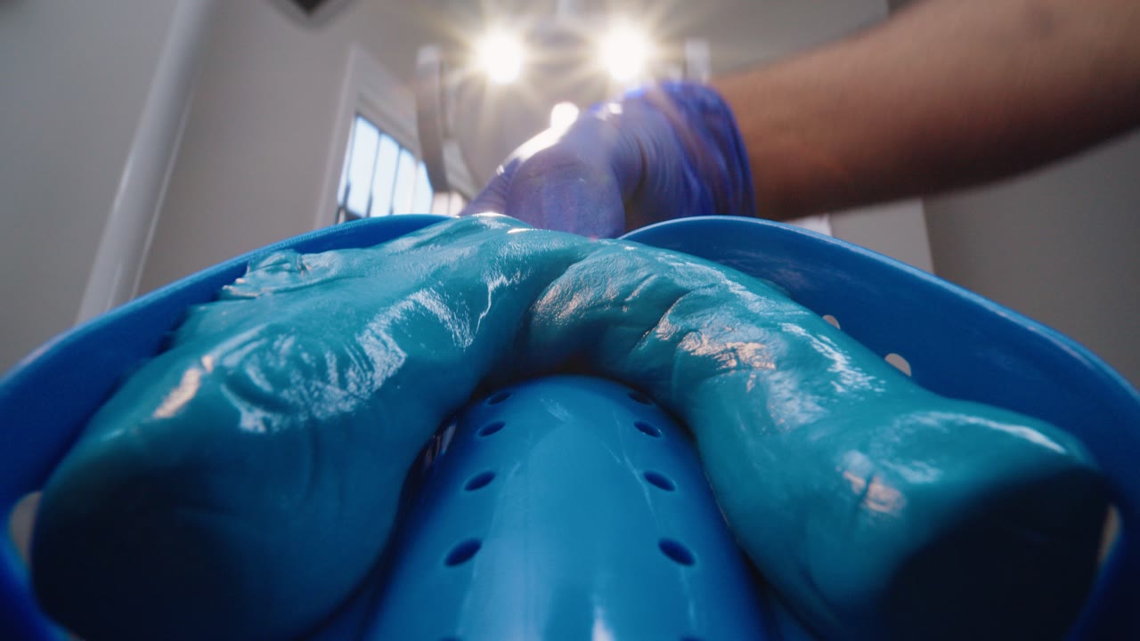 A surgical team mid-procedure in theatre